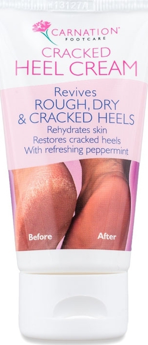 Vican Carnation Cracked Heel Cream 50ml - Κρέμα Για Σκασμένες Φτέρνες